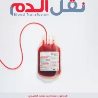 نقل الدم.